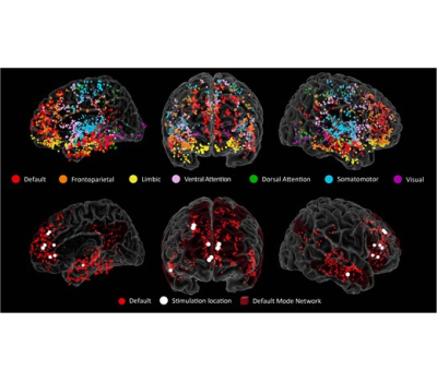 088_brain